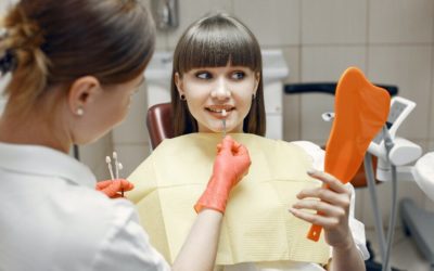 10 lietas, kas Jums jāzina par zobu venīriem