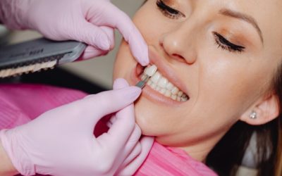 Biežākās zobu problēmas, lai ievietotu zobu venīrus un kā notiek ievietošanas process?
