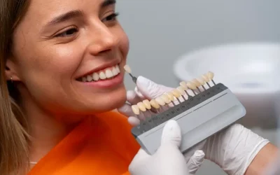 Zobu venīri – Ko sagaidīt no procedūras?
